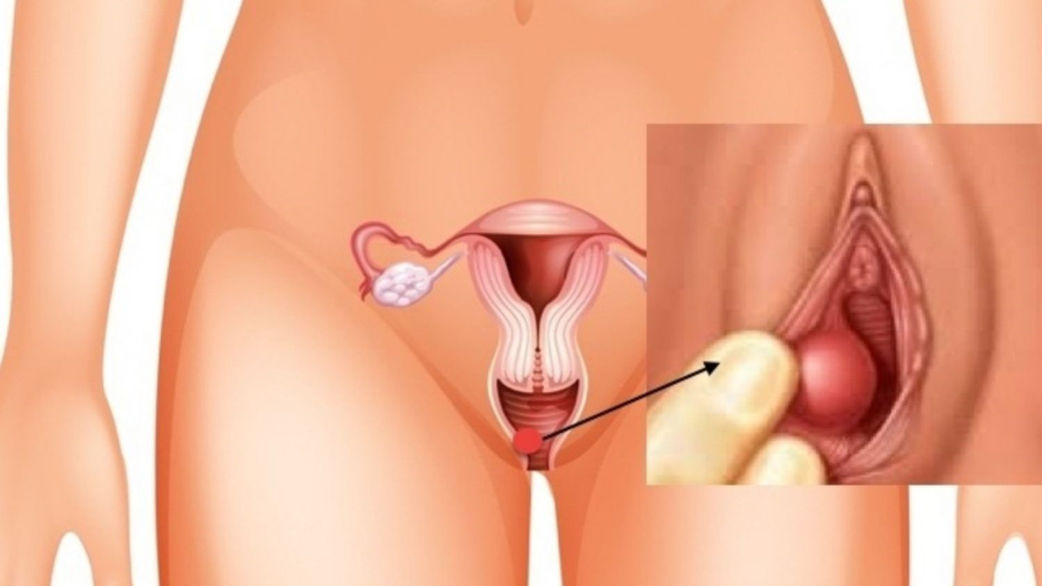 Phì đại âm vật là gì? Cách điều trị ra sao? - Nhà thuốc FPT Long Châu